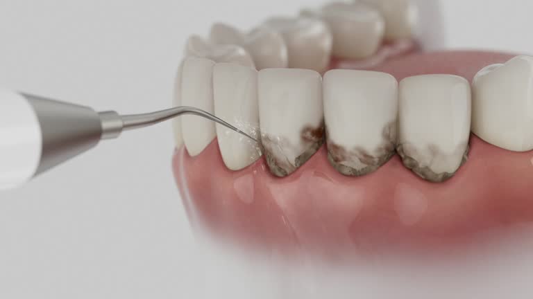 Reliable Dental contractor in LaGrange, OH by Dentist Open Now
